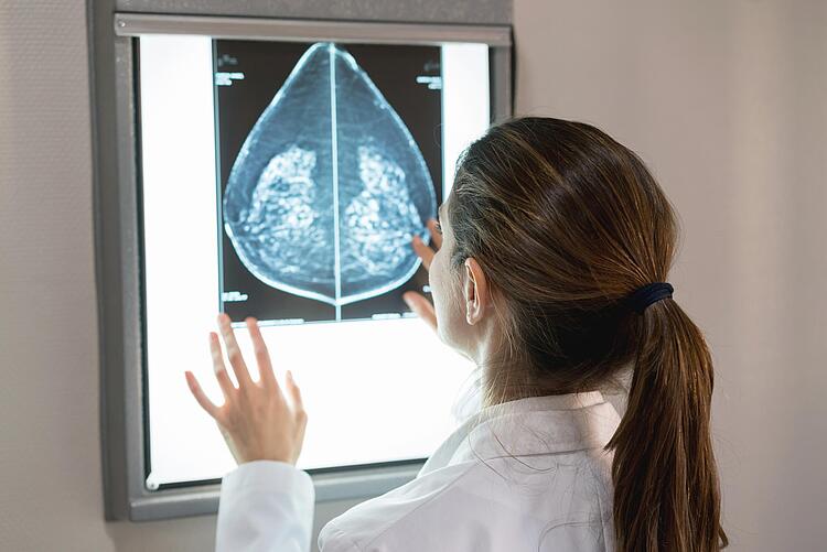 Für und Wider des Mammographie-Screenings