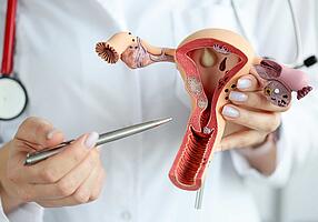 Arzt zeigt mit einem Stift auf ein Modell von Gebärmutter und Eierstöcken