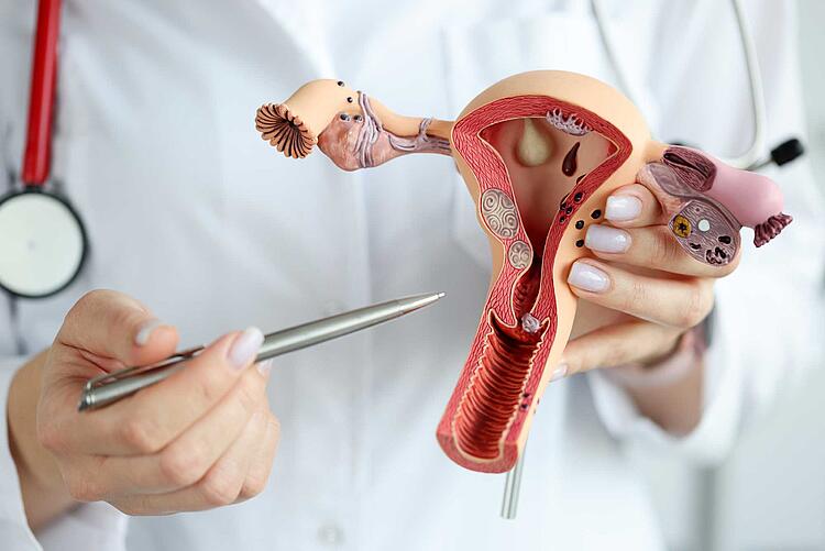 Arzt zeigt mit einem Stift auf ein Modell von Gebärmutter und Eierstöcken