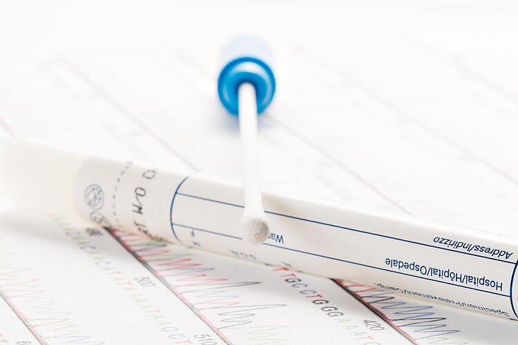 Wattestäbchen und Röhrchen für einen Wisch DNA Test.