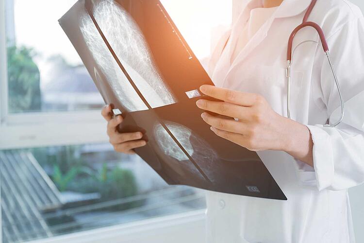 Ärztin betrahtet Aufnahmen eines Mammographie-Screenings
