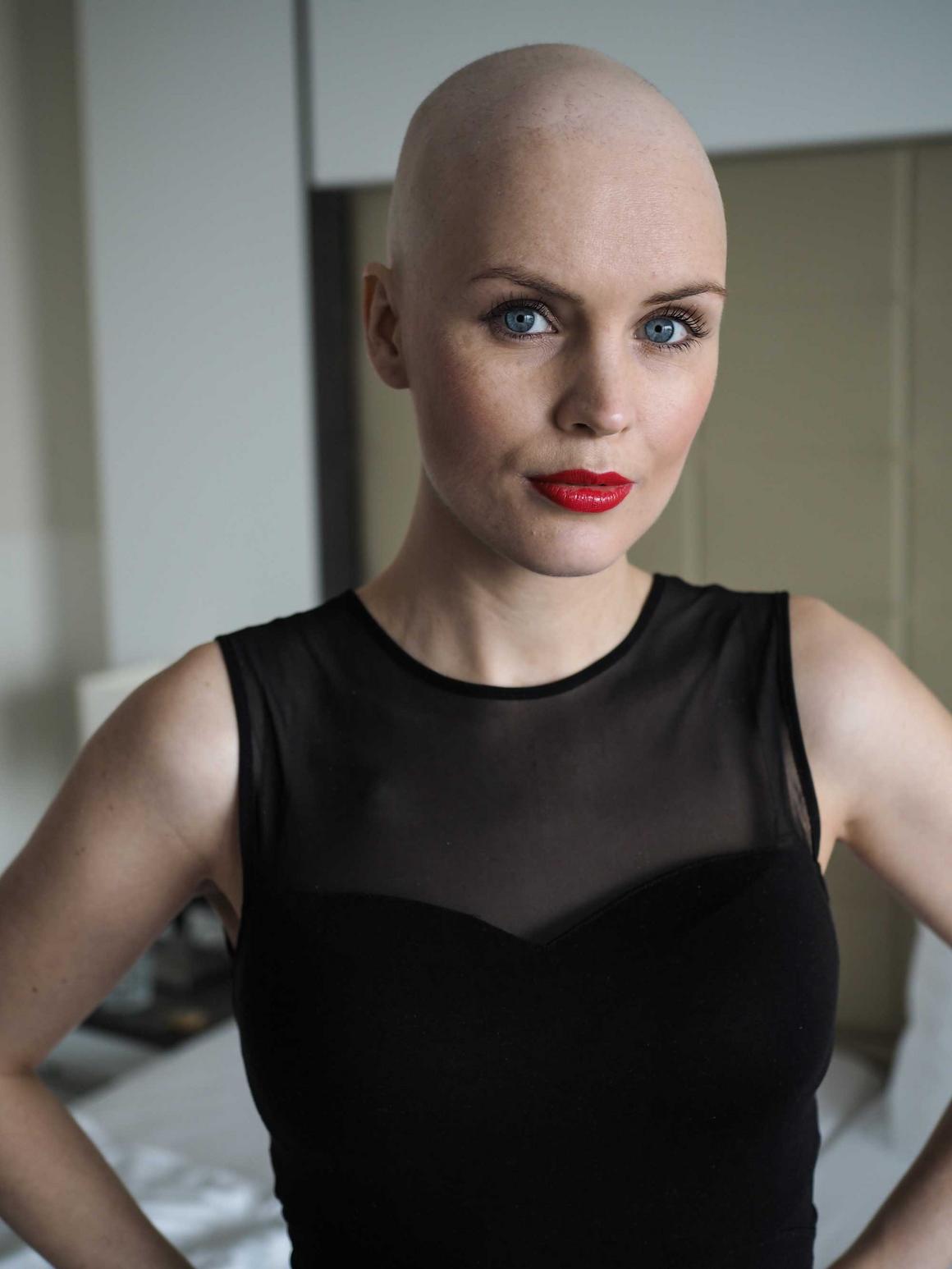 / © Georg Verhasselt Carolin Kotke ohne Haare