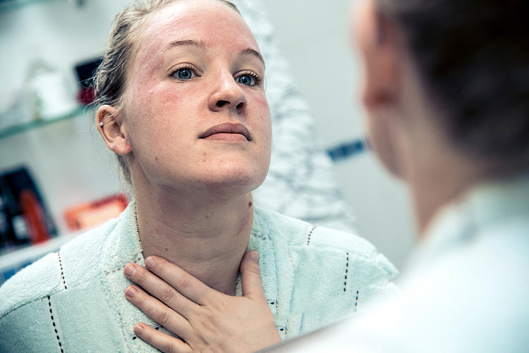 Junge Frau mit einer allergischen Reaktion betrachtet Gesicht und Hals im Spiegel.