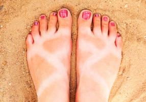 Gebräunte Füße mit weißen Abdrücken von Schuhen