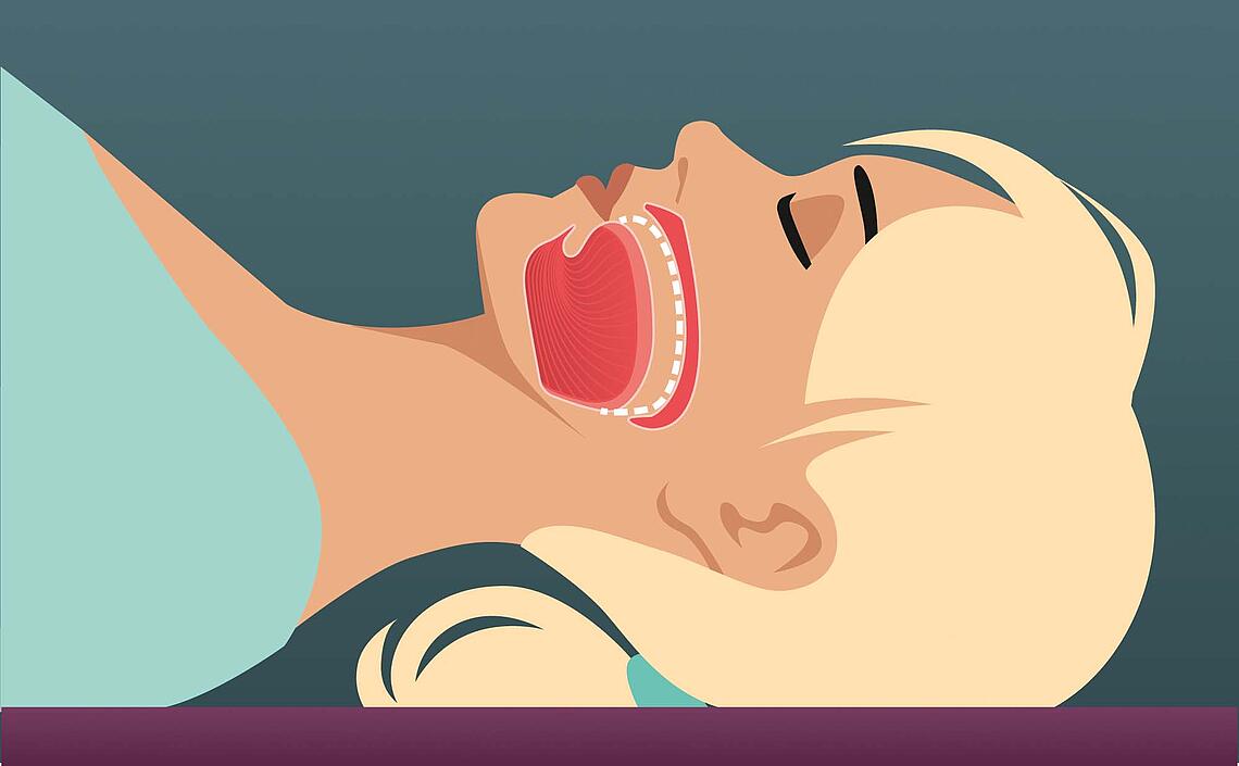 Illustration Muskelentspannung nach Jacobson, Übung 4: Zunge gegen den Gaumen drücken.