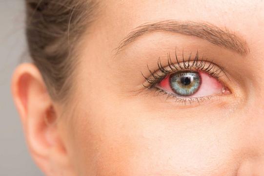 Können Kontaktlinsen Pilzinfektionen am Auge auslösen?