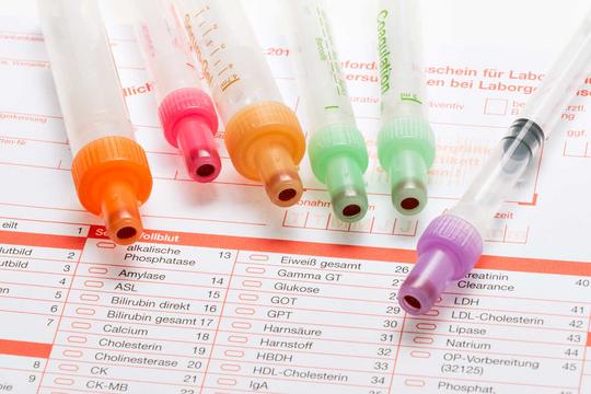 Blutwerte: Was sie bedeuten und wie Sie Ihre Gesundheit gezielt unterstützen