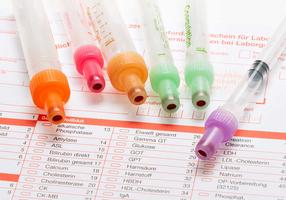 Blutwerte: Verschiedene Röhrchen für Blutproben auf einem Laborbericht