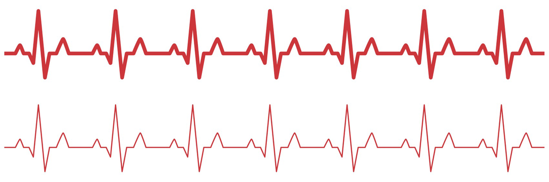 Was ist der Sinusrhythmus?