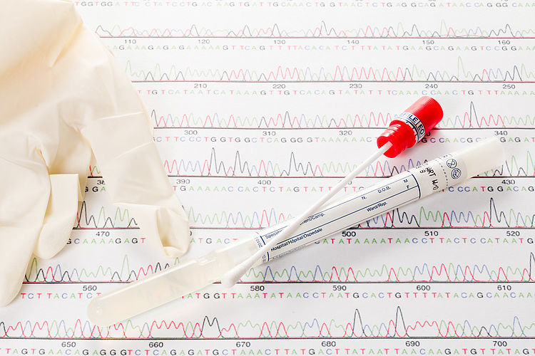 Wattestäbchen und Röhrchen für einen DNA Test. - Bildnachweis: © istockphoto.com / fotoquique Wattestäbchen und Röhrchen für einen DNA Test.