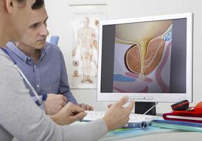 Arzt und Patient betrachten die Illustration einer Prostata auf dem Computer