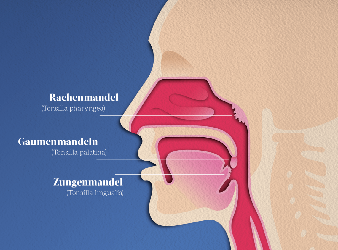 Illustation der Gaumenmandeln, Rachenmandel und Zugenmandel.