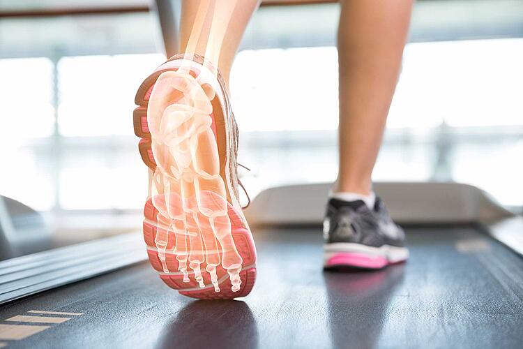 Füße einer Frau auf einem Laufband, auf dem linken Fuß sind die Knochen als Illustration eingefügt