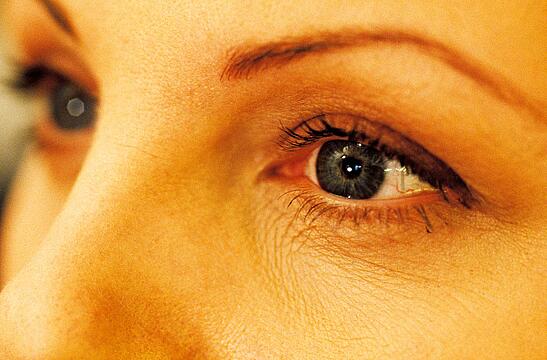 Können Kontaktlinsen Pilzinfektionen am Auge auslösen?