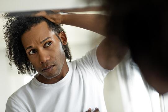 Was ist erblich bedingter Haarausfall?