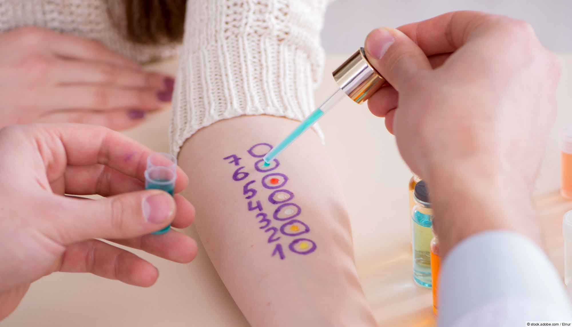 Was ist ein Pricktest?